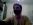 Osobn� zku�enosti a v�sledky s transplantac� vlas�