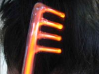 ozonoterapie vlasov sti hlavy