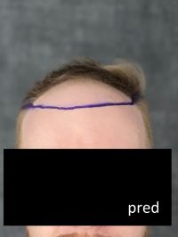 PRED